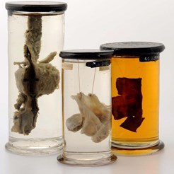 Specimens from the Collections of Robert Knox and Charles Bell, Acquired by RCSEd in the 1820s