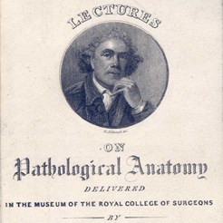 Class Card for Lectures on Pathological Anatomy by Robert Knox, RCSEd